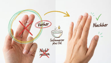 Sekundenkleber entfernen von Fingern – Vorher-Nachher-Vergleich nach Behandlung mit Seifenwasser und Öl, nicht reißen